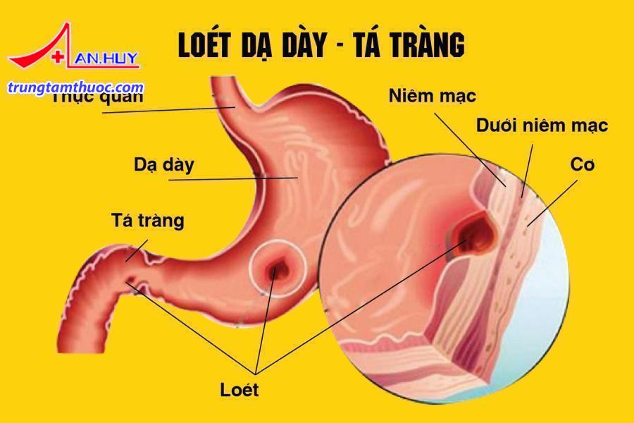loet_da_day_ta_trang