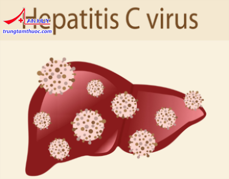 Viêm gan virus C