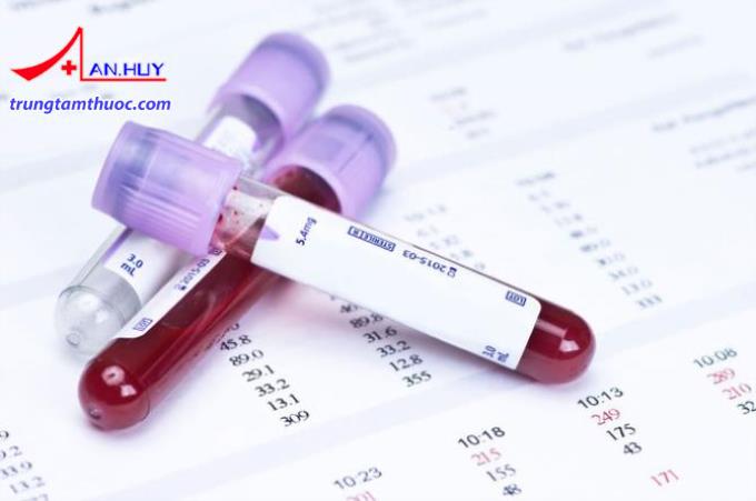 Xét nghiệm chẩn đoán viêm gan B