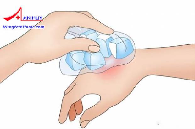 Chườm đá vị trí bị côn trùng cắn