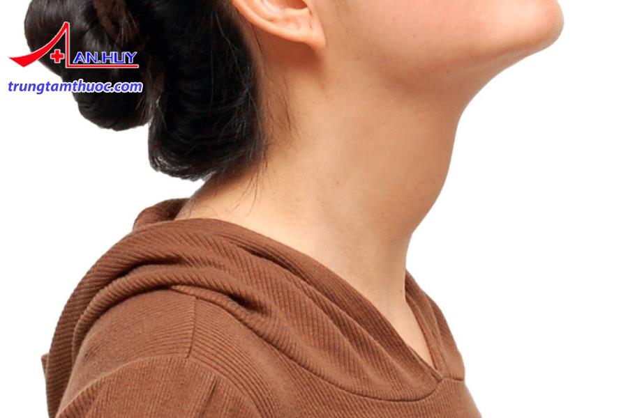 Chẩn đoán bệnh nhân bị bướu giáp đơn thuần như thế nào?