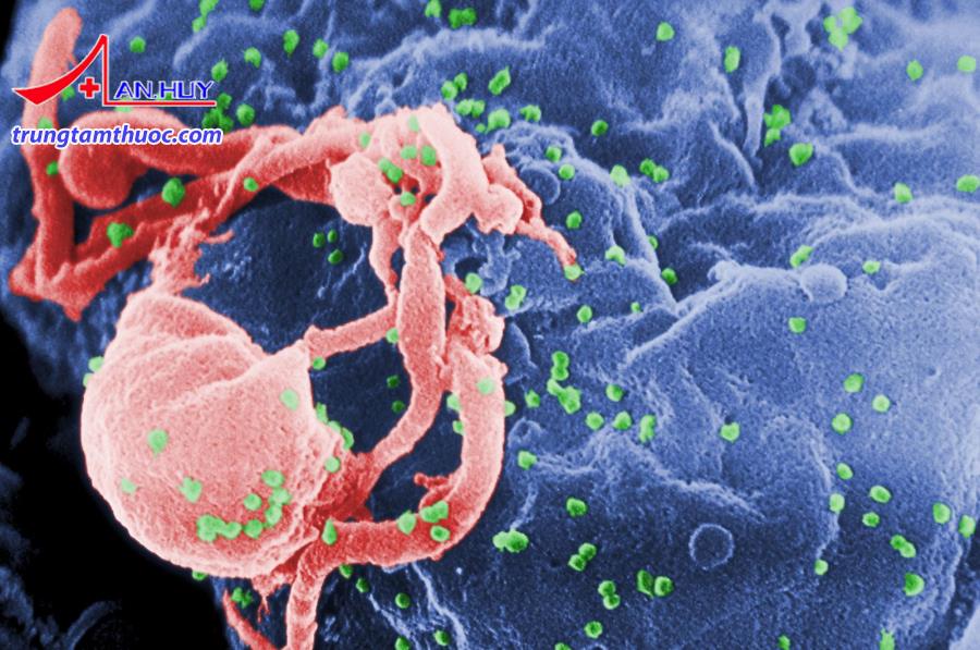 Cần làm gì để chẩn đoán HIV/AIDS?