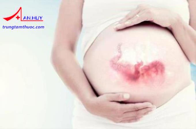 Sắt giúp thai nhi khỏe mạnh