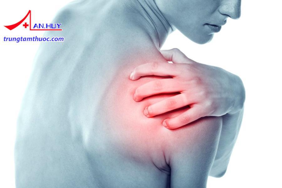 Viêm quanh khớp vai được chẩn đoán như thế nào?