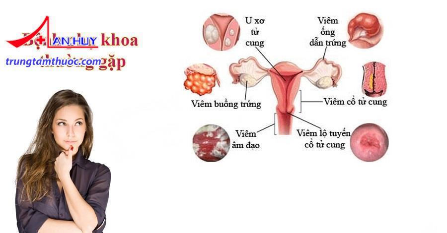 Một số bệnh phụ khoa thường gặp