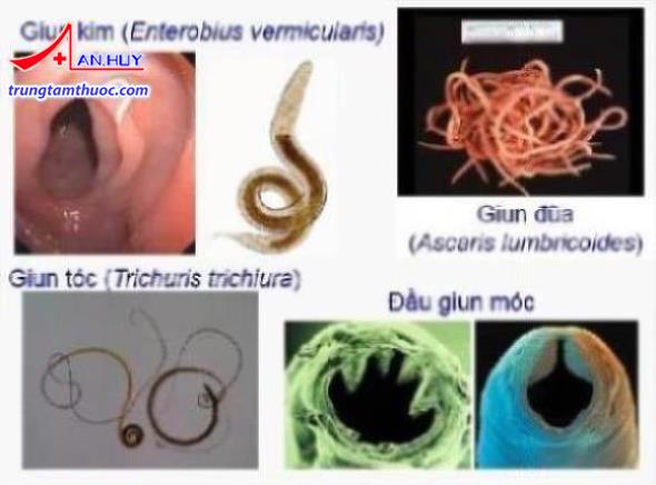 giun gây bệnh ở người