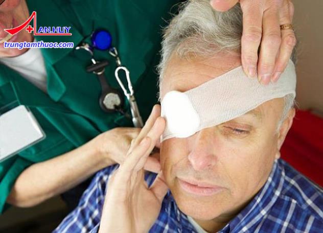Nhãn viêm giao cảm thường gặp ở bệnh nhân bị chấn thương mắt