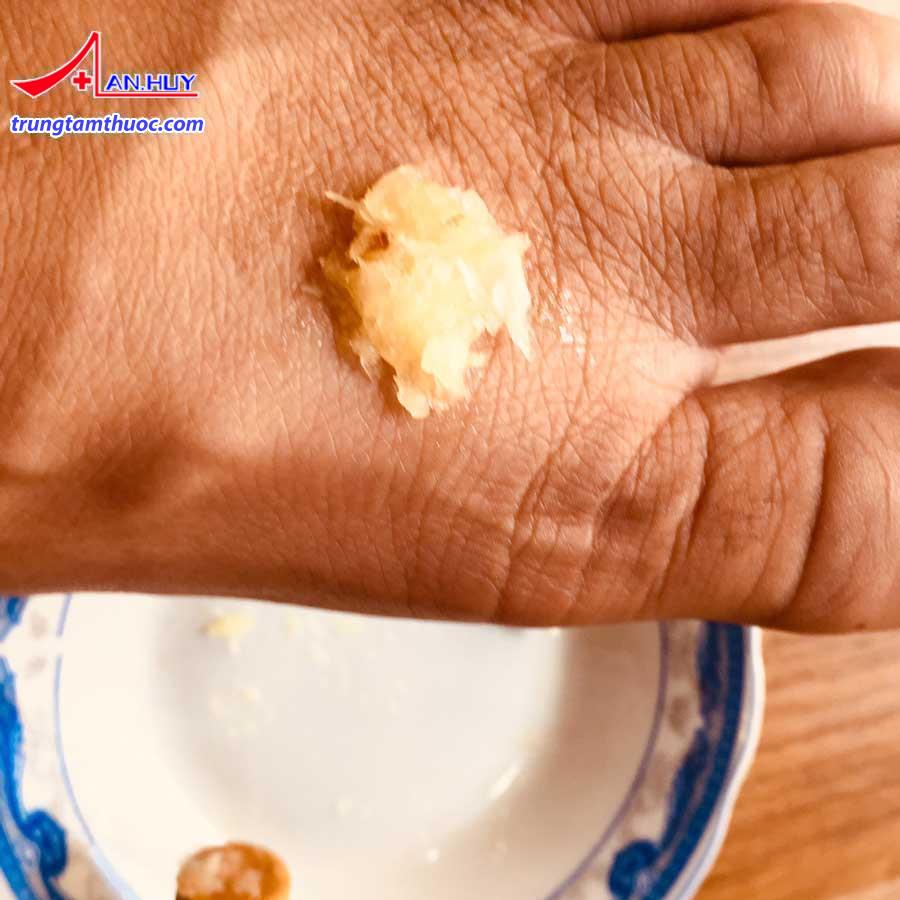 Chữa mụn cóc bằng tỏi tại nhà 5 ngày hết 100% thành công