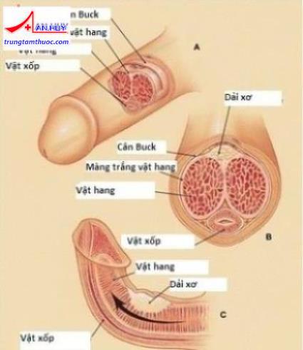 Xơ cứng vật hang