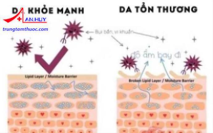 Da bị tổn thương bởi các tác nhân gây bệnh.
