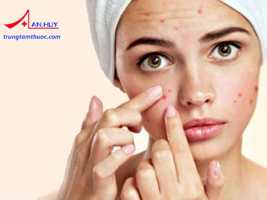 giai đoạn dậy thì dễ bị mụn