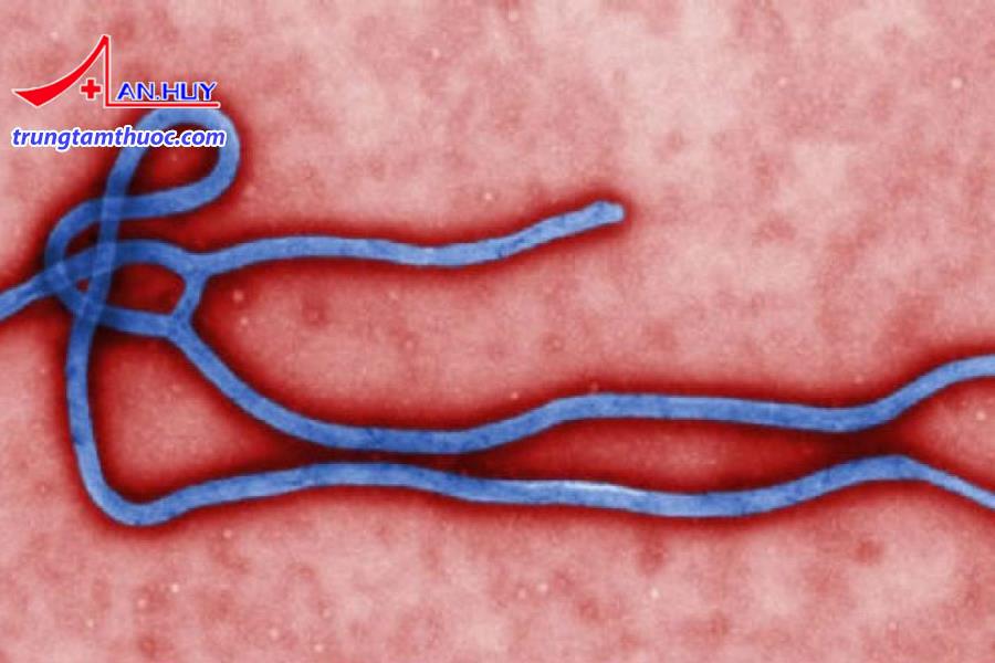 Ebola là bệnh virus truyền nhiễm nguy hiểm.