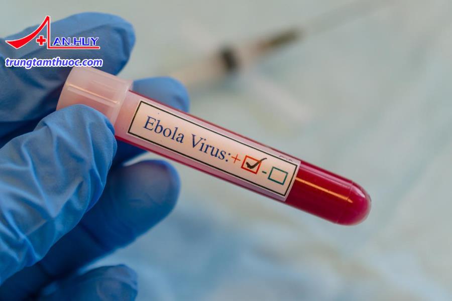 Ebola được chẩn đoán bằng cách nào?