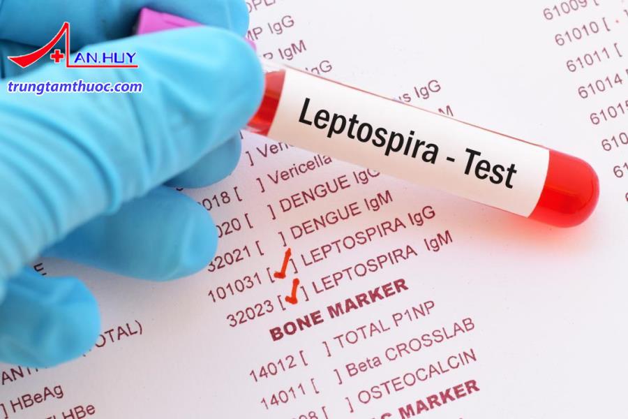 Leptospirosis có những triệu chứng lâm sàng và cân lâm sàng như thế nào?