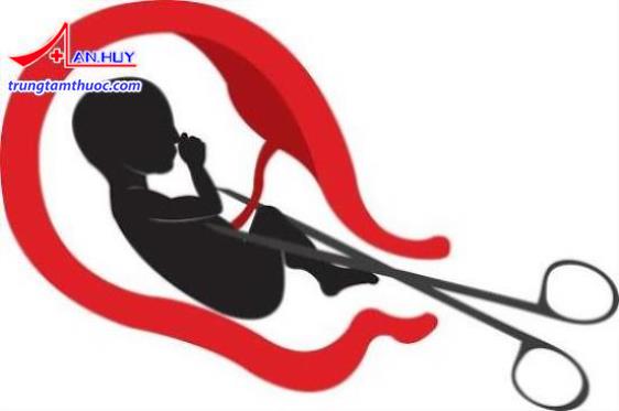 Nạo phá thai cũng là một nguyên nhân gây bệnh phụ khoa