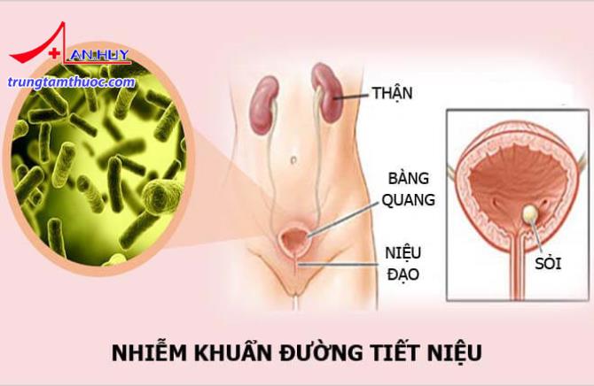 Nhiễm khuẩn đường tiết niệu