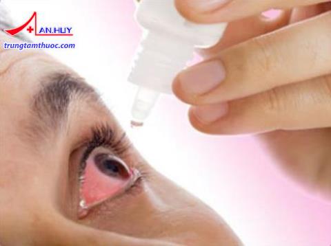 Điều trị viêm kết mạc cấp do dị ứng