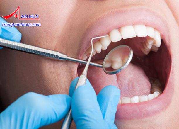 Khám răng định kỳ để phòng ngừa áp xe răng