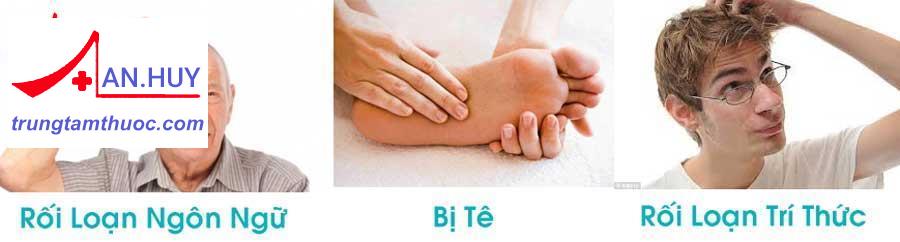 rối loạn đầu óc rối loạn tri thức tê chân tay
