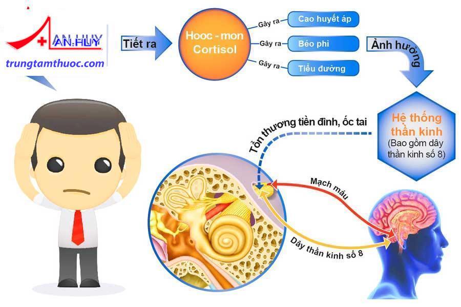 Rối loạn tiền đình