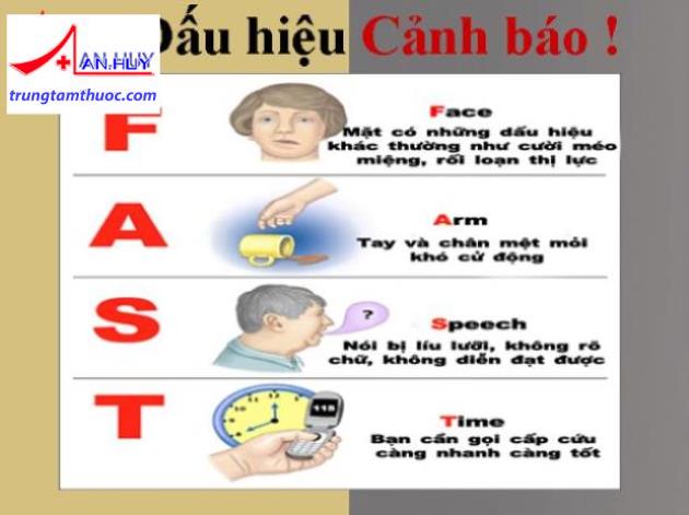 Tai biến mạch máu não / Dấu hiệu Cảnh Báo