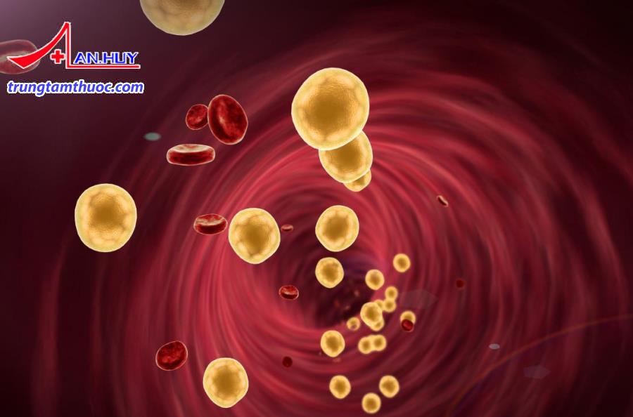 tang_lipid_mau