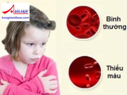 Thiếu máu ở trẻ em