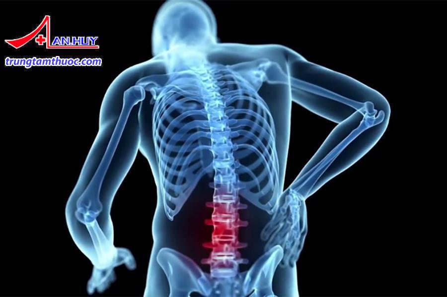 Thoái hóa cột sống thắt lưng là gì?