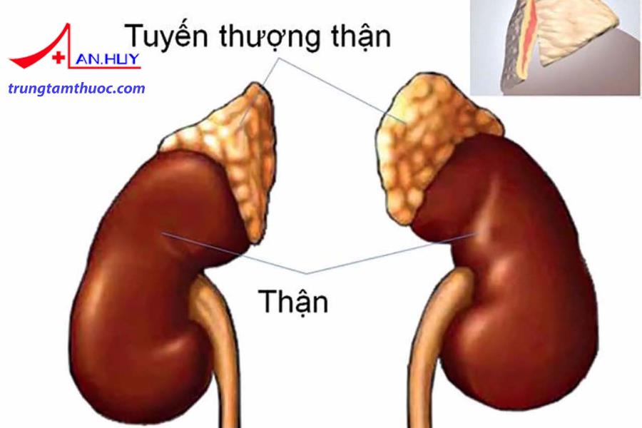 Cường aldosteron tiên phát có những triệu chứng gì?