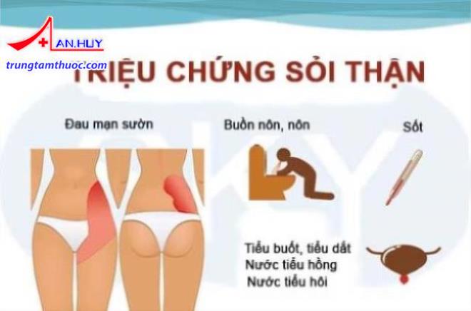 Triệu chứng bệnh sỏi thận
