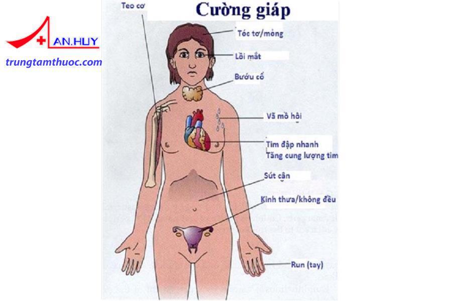 Người bệnh cường giáp có những triệu chứng như thế nào?