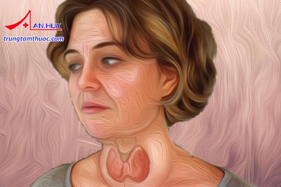 Điều trị cho bệnh nhân nhiếm độc giáp cấp như thế nào?