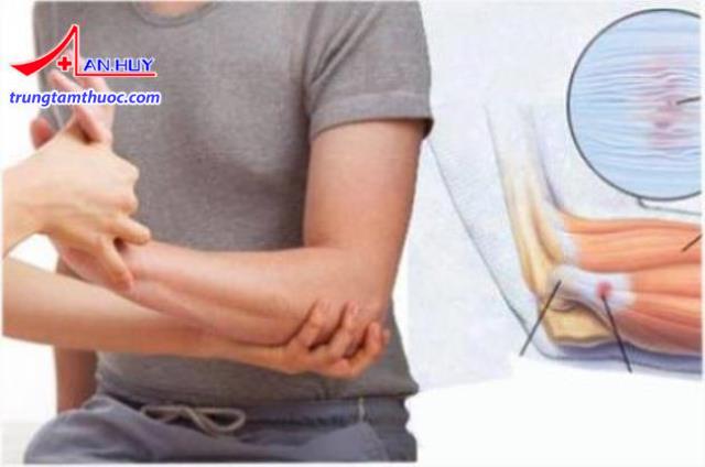 Các phương pháp điều trị viêm điểm bám gân và mô mềm quanh khớp.