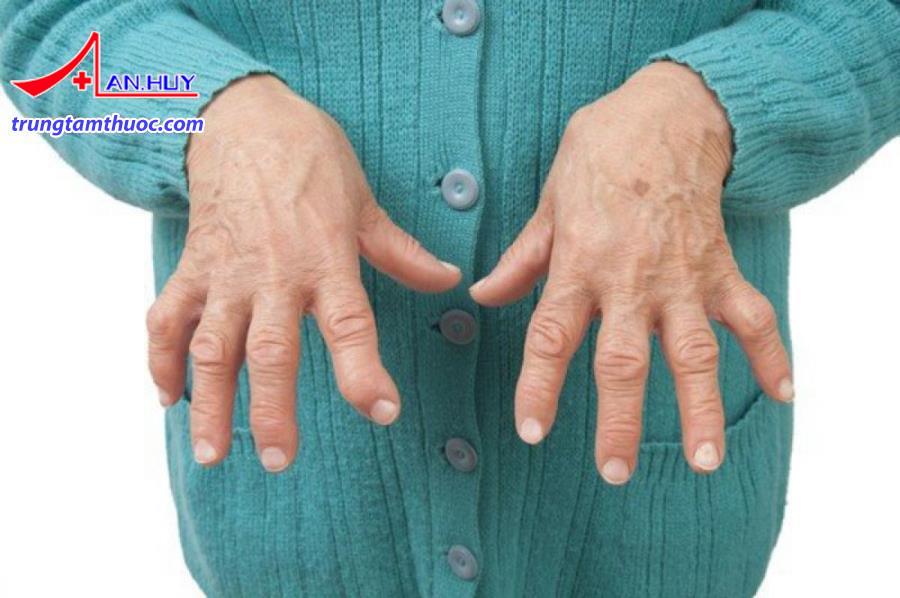 Viêm khớp dạng thấp được chẩn đoán như thế nào?