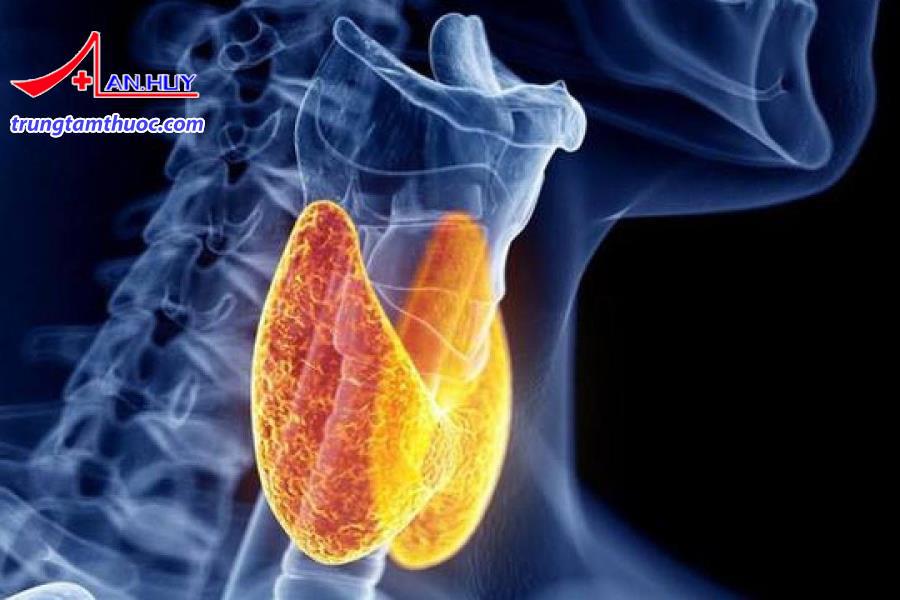 Viêm tuyến giáp bán cấp là gì?
